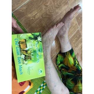 Liệu Trình 3 Thang Chè chữa giãn tĩnh mạch 0337787746