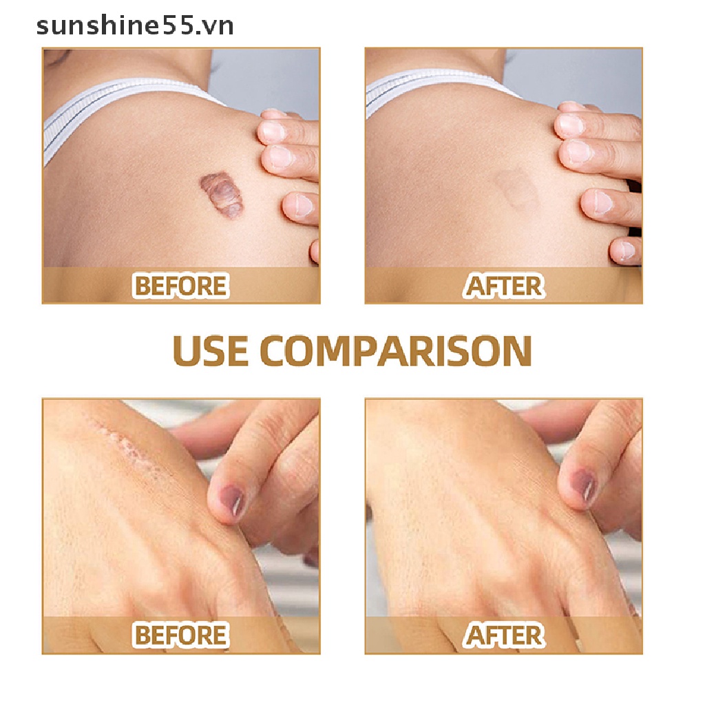 Bộ 60 Miếng Dán Che Khuyết Điểm Hình Xăm Chống Nước Che Phủ Mỏng