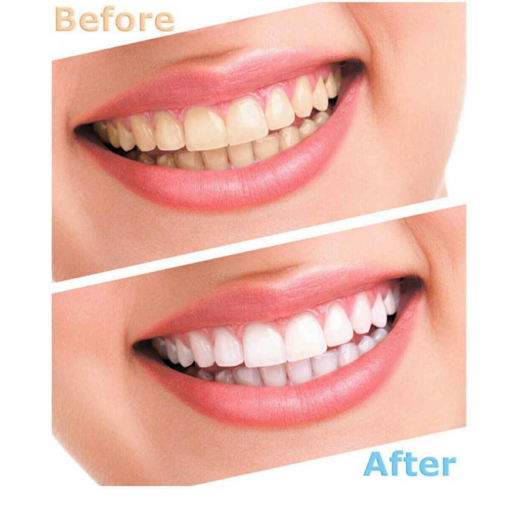 Bút Tẩy Trắng Răng Dazzling White Professional Strength Instant Whitening Pen 1,8g
