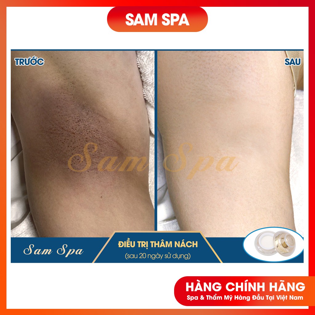 Kem Mờ Thâm Nách, Kem Mờ Thâm Bẹn Hàng Chuẩn Spa 30gr