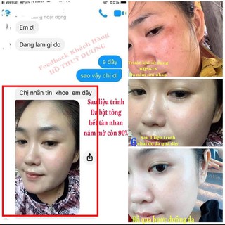 [CHÍNH HÃNG 100%-FAKE ĐỀN 1 TỶ] KEM FACE NHÂN SÂM MQSKIN