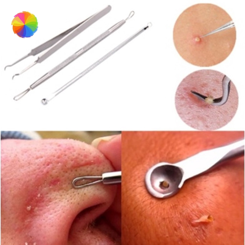 Bộ 3 cây nặn mụn tiện dụng