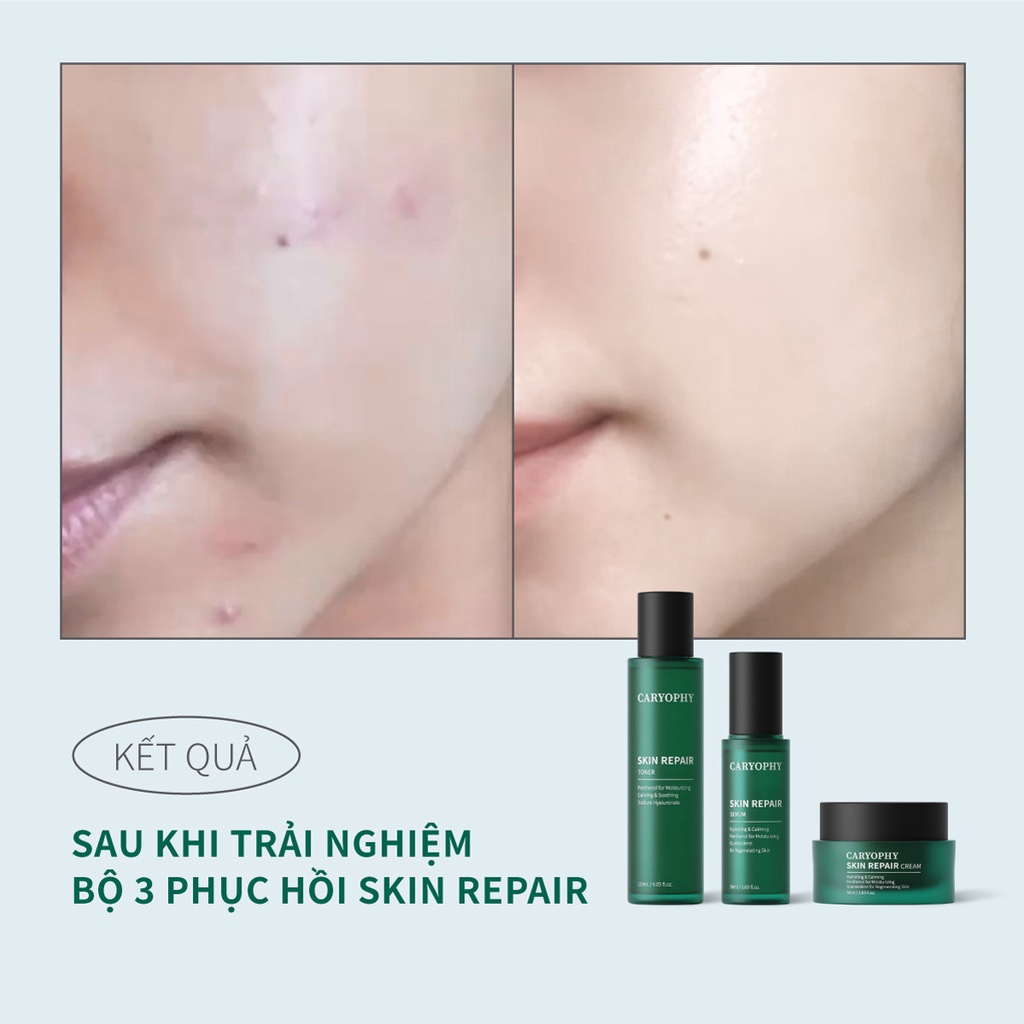 Kem dưỡng ẩm phục hồi da nhạy cảm Caryophy Skin Repair Cream 50ml