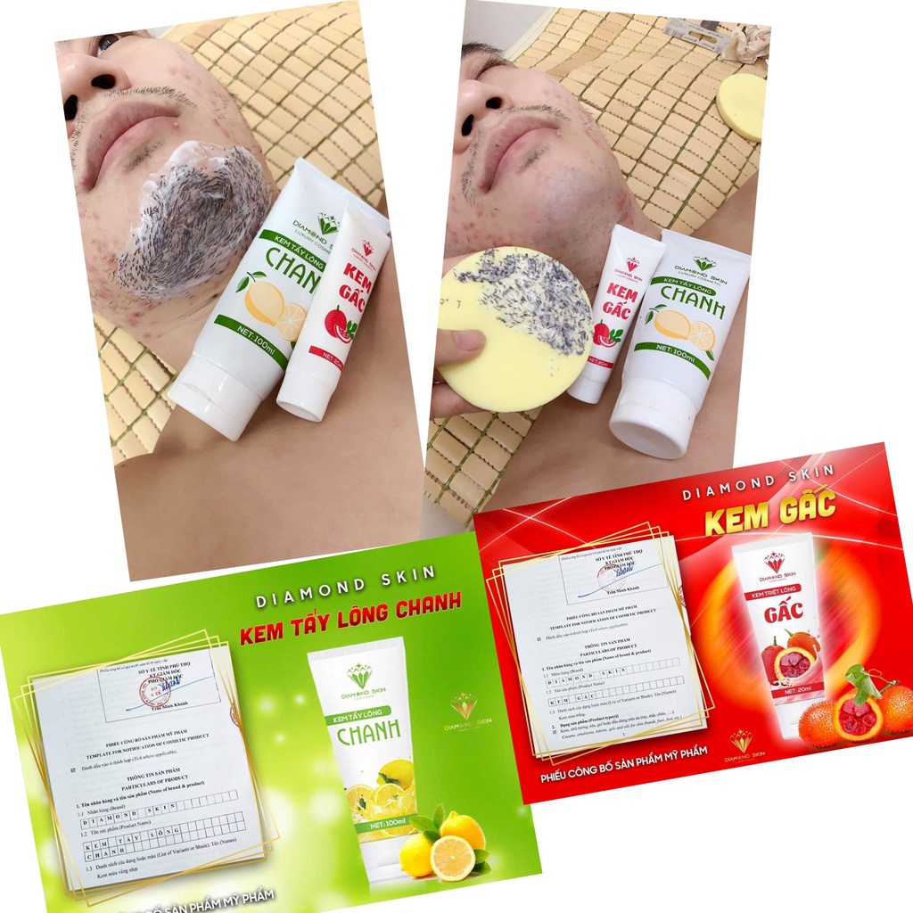 Combo Kem Tẩy Lông Chanh Gấc Triệt Lông Tại Nhà Hiệu Quả Không Mọc Lại | BigBuy360 - bigbuy360.vn