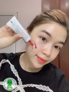 (TUÝP 20ML) THAY DA SINH HỌC RED PEEL TINGLE SERUM