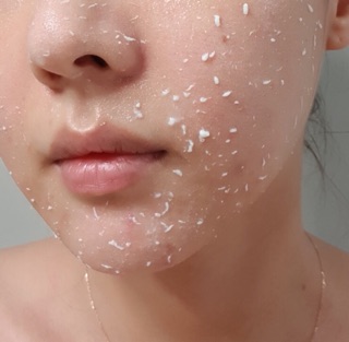 Tẩy tế bào chết Tea Tree Peeling Gel