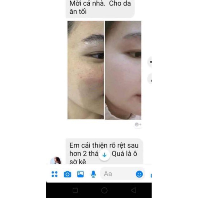 Combo Dưỡng Ngày Đêm Laco | BigBuy360 - bigbuy360.vn