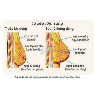 MẦM ĐẬU NÀNH MẸ KEN