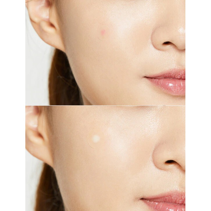 Miếng dán mụn Cosrx Acne Pimple Master Patch (Đỏ) / Cosrx Clear Fit Master Patch (Đen) | BigBuy360 - bigbuy360.vn
