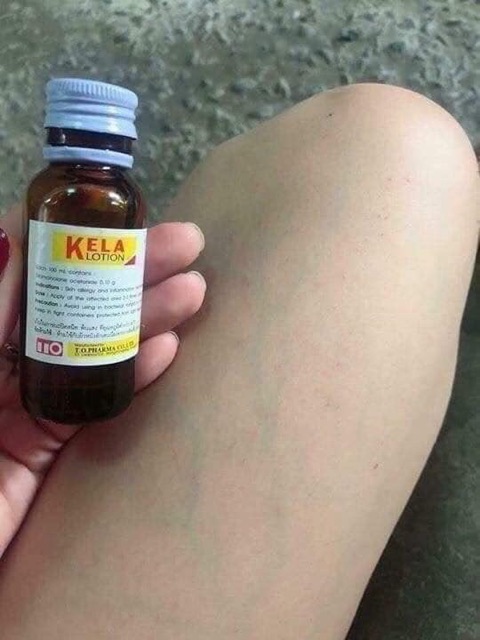 kela lotion