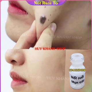 Tẩy Nốt Ruồi Mụn,Mụt Cóc,Tàn Nhang Mụn Thịt,Mắc Cá
