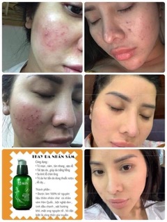 Serum thay da nhân sâm