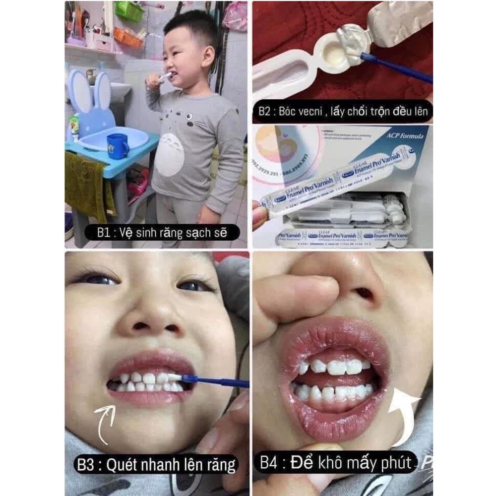 Vecni flour 💎 kem bôi răng chống sâu răng, sún răng cho bé