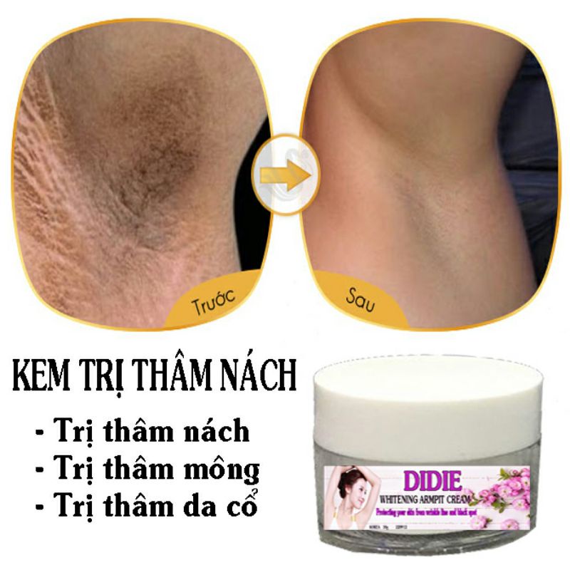 Kem Xóa Thâm Trắng Nách Se Khích Lỗ Chân Lông