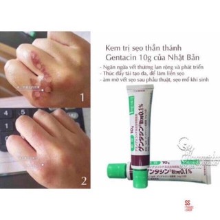 Kem sẹo Gentacin