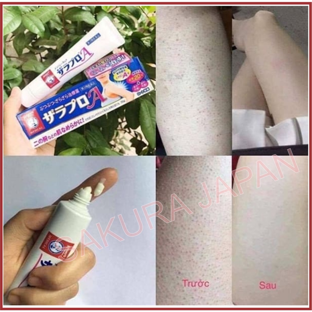 Kem loại bỏ viêm nang lông Zaraporo Rohto Nhật Bản_Hết viêm lỗ chân lông giảm sưng viêm á sừng thô ráp
