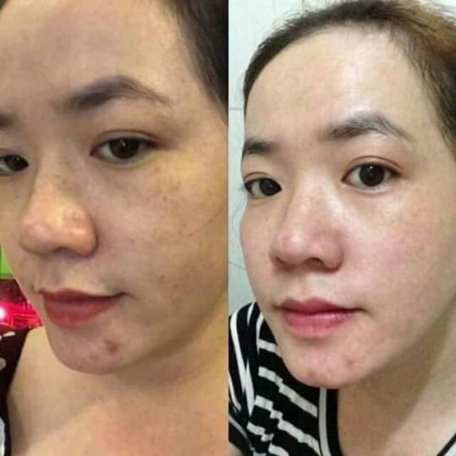 BỘT CÁM GẠO CC COLLAGEN ANTHY