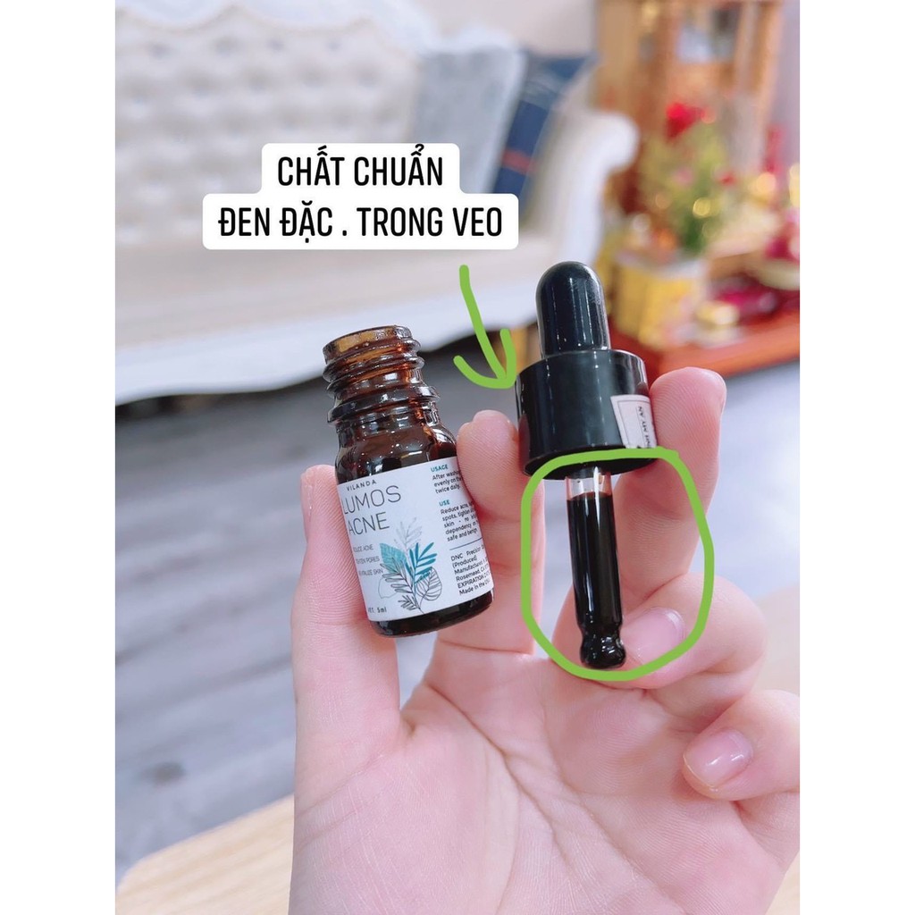 [Mẫu mới] Serum mụn Lumos Ance Hàng chuẩn check Code, date mới | BigBuy360 - bigbuy360.vn