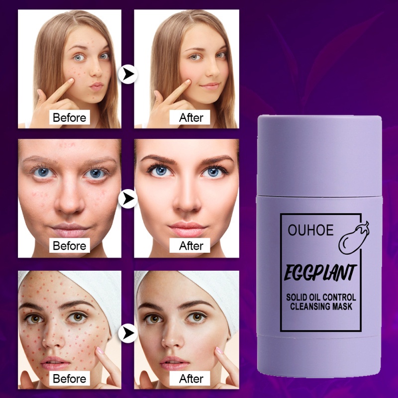 (Hàng Mới Về)Mặt Nạ Bùn Trà Xanh Kiềm Dầu Dưỡng Ẩm Loại Bỏ Mụn Đầu Đen Se Khít Lỗ Chân Lông Hiệu Quả UN | BigBuy360 - bigbuy360.vn