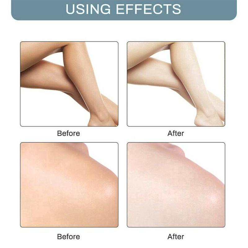 Kem Dưỡng Trắng Da Vùng Dưới Cánh Tay / Đầu Gối / Toàn Thân 60g