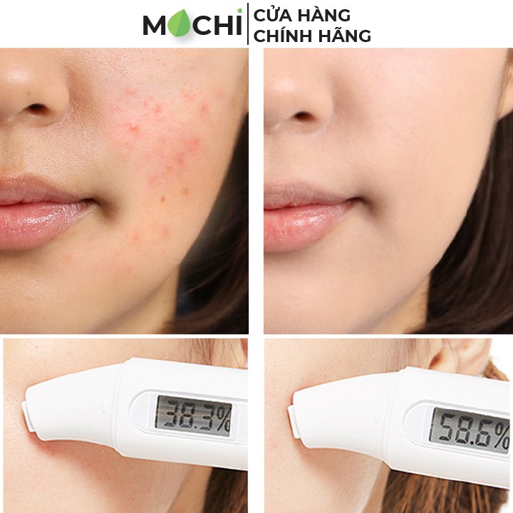 Mặt Nạ Ngủ Nha Đam Lô Hội BIOAQUA Cấp Ẩm, Dưỡng Trắng, Thải Độc Giảm Mụn Nội Địa Trung Chính Hãng - MOCHI SHOP | BigBuy360 - bigbuy360.vn