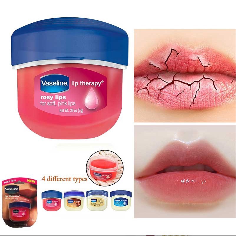 Son dưỡng môi jelly Vaseline giữ ẩm hydrat hóa da môi 7g | BigBuy360 - bigbuy360.vn