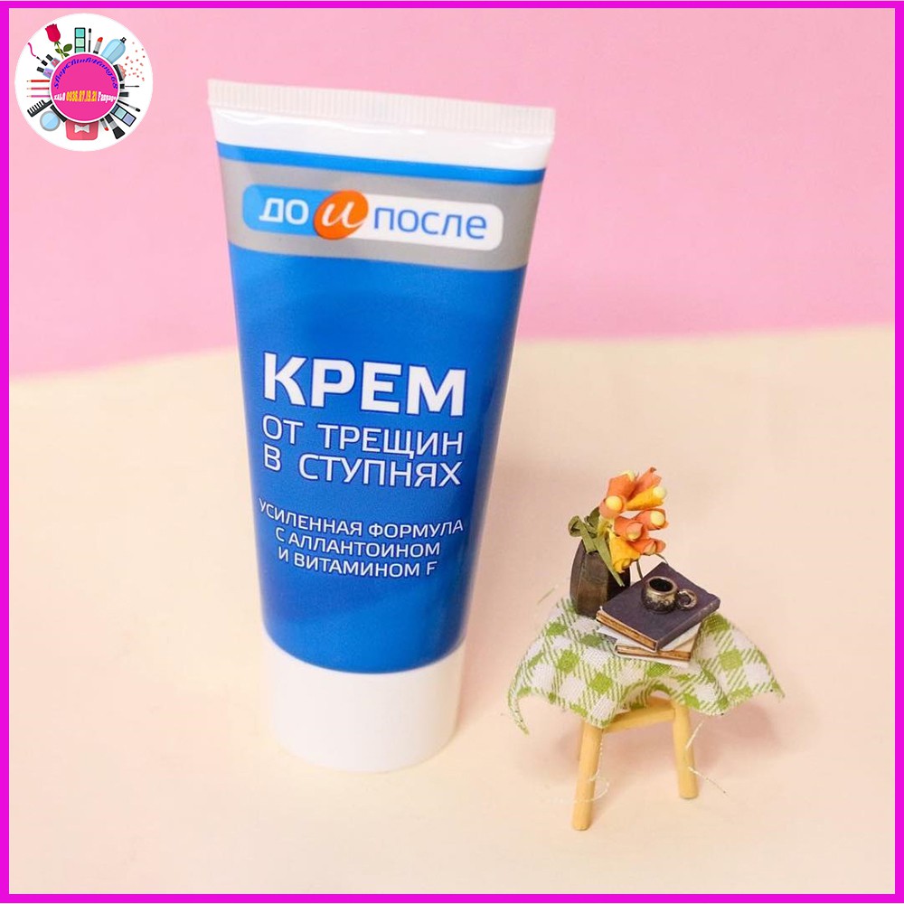 Kem Trị Nứt Gót Chân KPEM Dưỡng Ẩm và Làm Mềm 50ml NGA | BigBuy360 - bigbuy360.vn