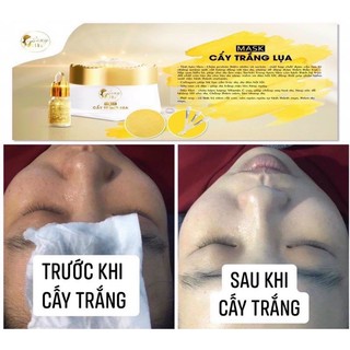 Cấy trắng phấn lụa