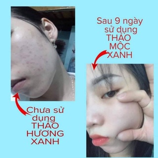 THẢO HƯƠNG XANH  SẠCH MỤN,HẾT THÂM