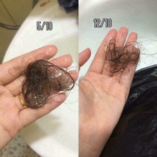 dầu gội trị rụng tóc