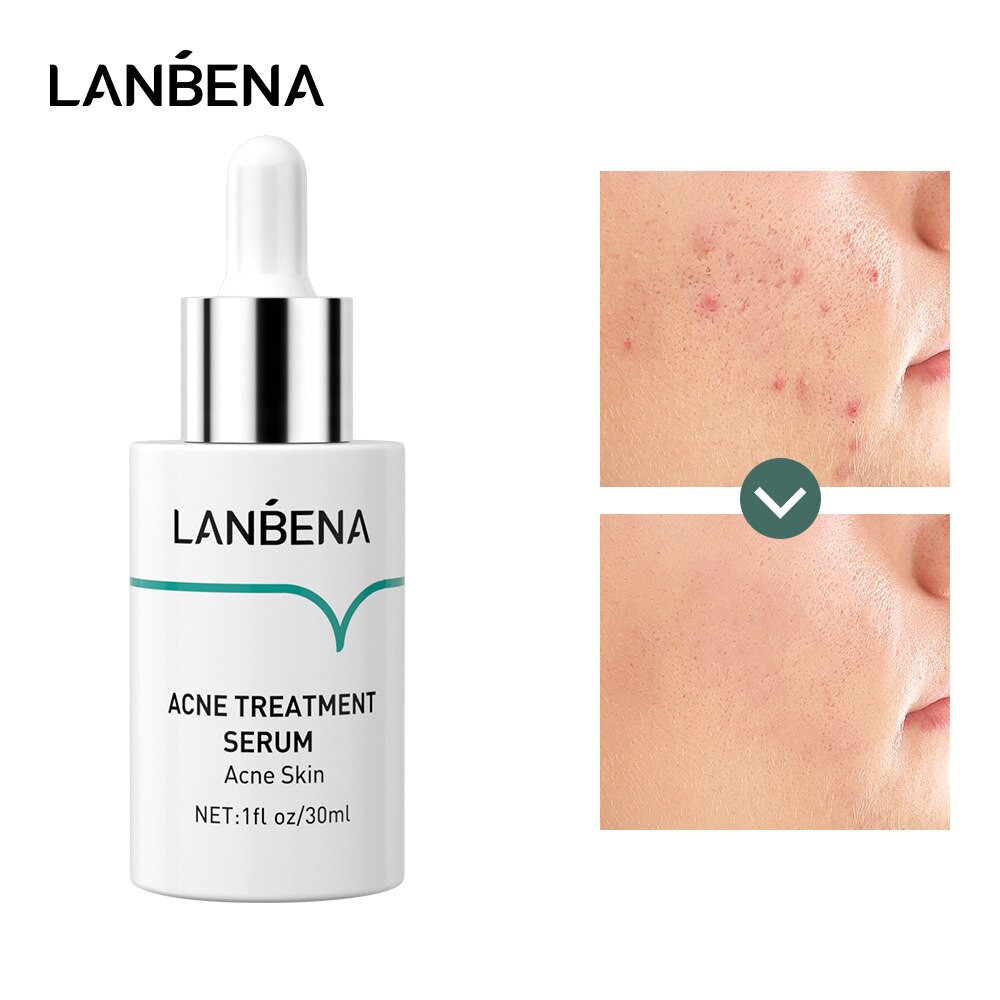 Serum hỗ trợ giảm mụn Lanbena dung tích 30ml