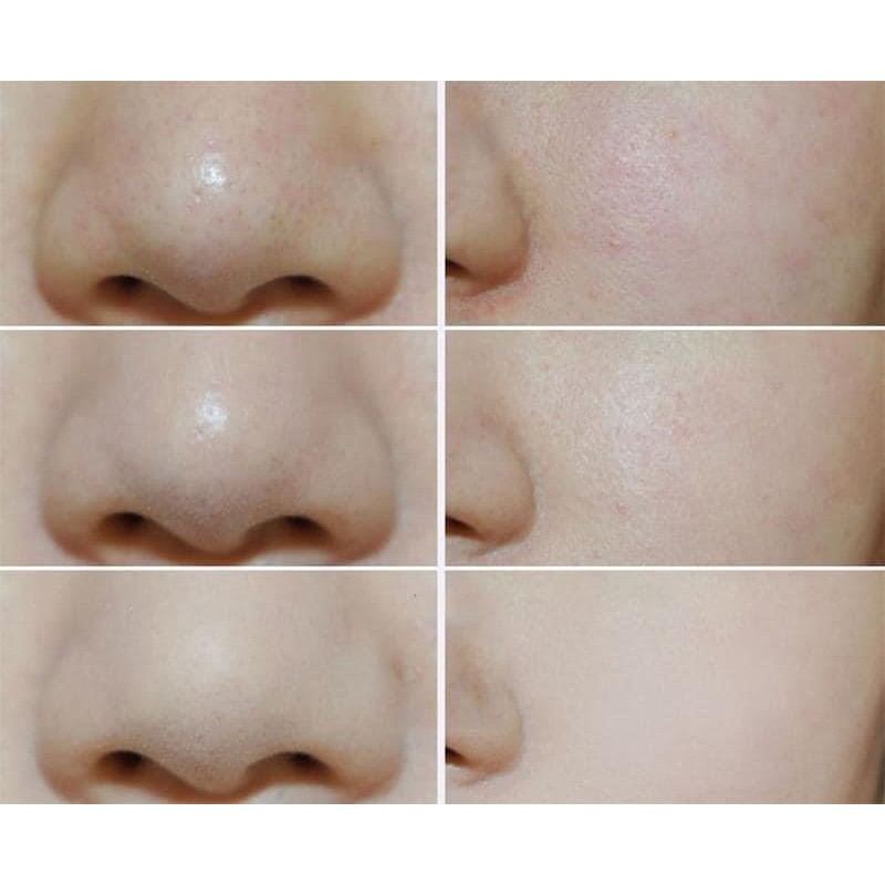 Phấn phủ dạng nén Shiseido Baby Pressed tươi sáng mịn màng - Bini.store.official