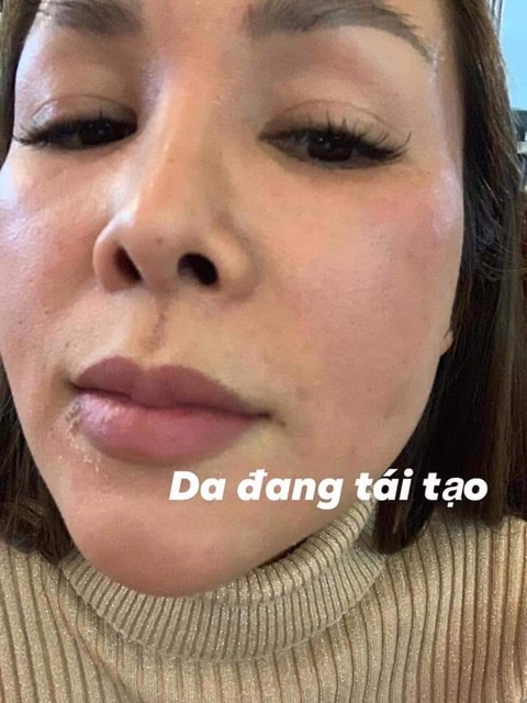 Combo Kem tái tạo + Hồng Sâm chamomile