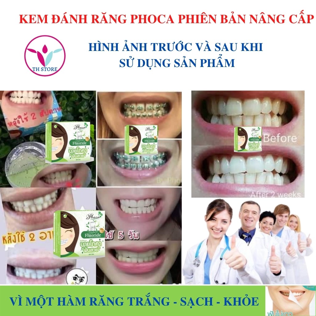 [Hàng chính hãng] Kem đánh răng trắng răng Phoca mẫu mới  - Kem đánh răng cho người niềng răng, viêm lợi và sâu ới