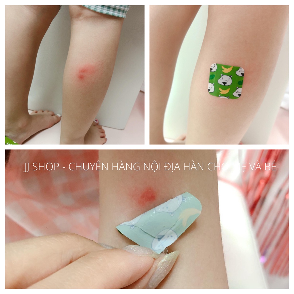 Miếng Dán Gel Lạnh HAMSOA Làm Dịu Vết Muỗi Cắn Côn Trùng Đốt Hàn Quốc