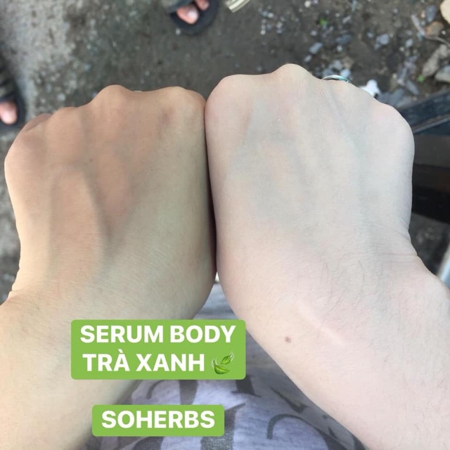 SERUM KÍCH TRẮNG TRÀ XANH