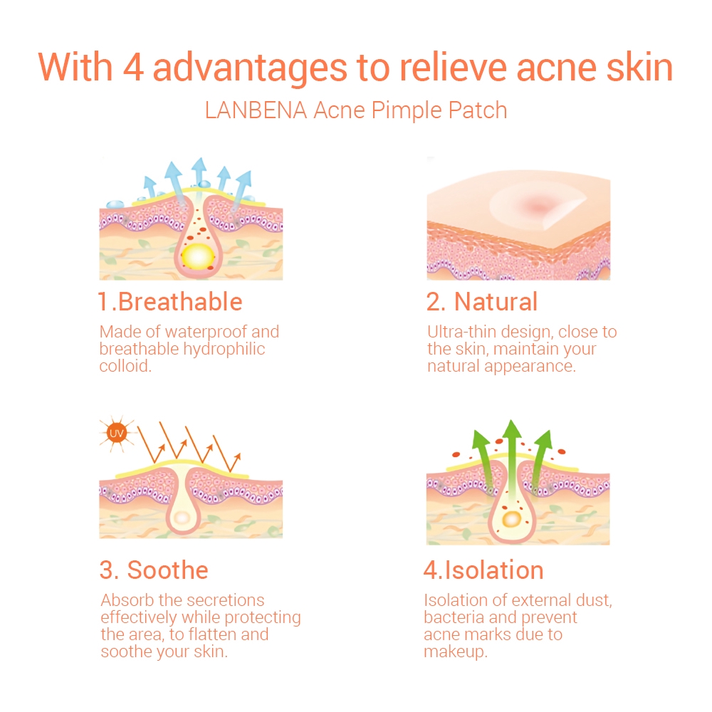 Bộ 25 miếng dán mụn vô hình LANBENA thoáng khí giúp chăm sóc làm dịu phục hồi làn da mặt sử dụng hàng ngày | BigBuy360 - bigbuy360.vn