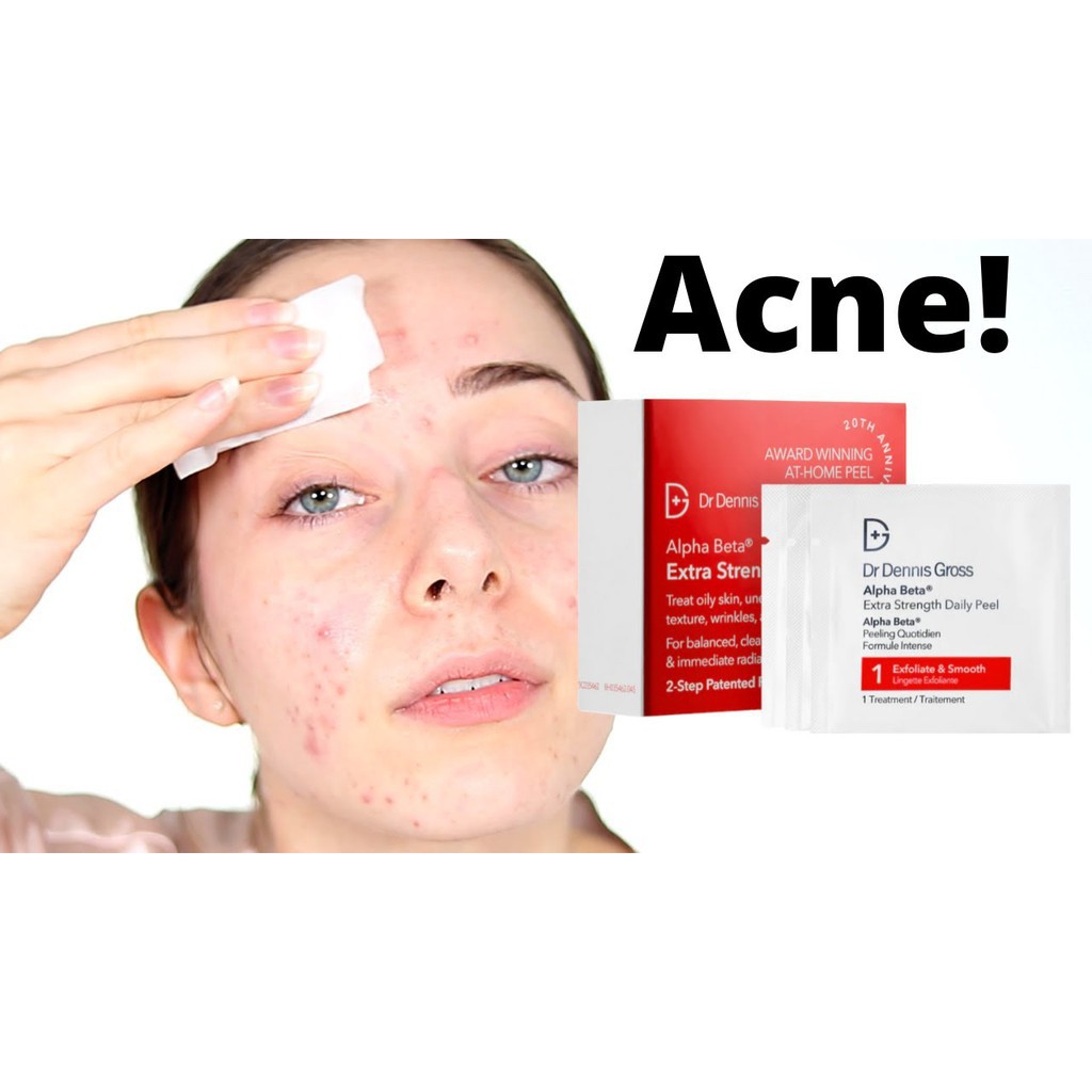 Tẩy Da Chết Tái Tạo Da Dr. Dennis Gross Skincare Alpha Beta® Peel Extra Strength Daily Peel | BigBuy360 - bigbuy360.vn