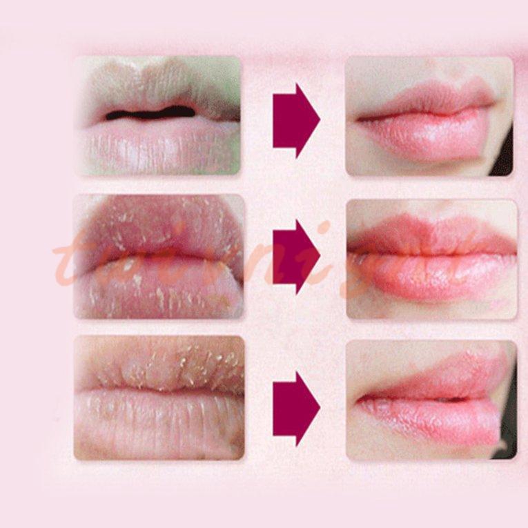 (hàng Mới Về) Mặt Nạ Môi Collagen Vàng Dưỡng Ẩm Và Phục Hồi Môi Hư Tổn | BigBuy360 - bigbuy360.vn