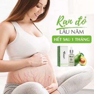 Tinh chất trị rạn da sau sinh..
