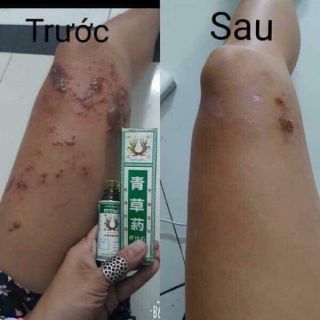 👉🏻👉🏻DẦU BÔNG LÚA MINYAK THÁI LAN