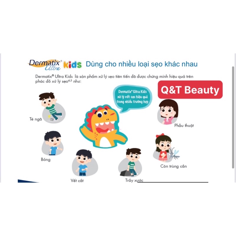 Dermatix Kids Gel mờ sẹo chuyên biệt  dành riêng cho trẻ  em