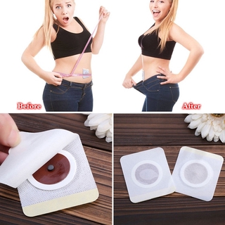 [Hàng mới về] Set 10 Miếng Dán Hỗ Trợ Giảm Cân Theo Phương Pháp Y Học Trung Quốc Hiệu Quả