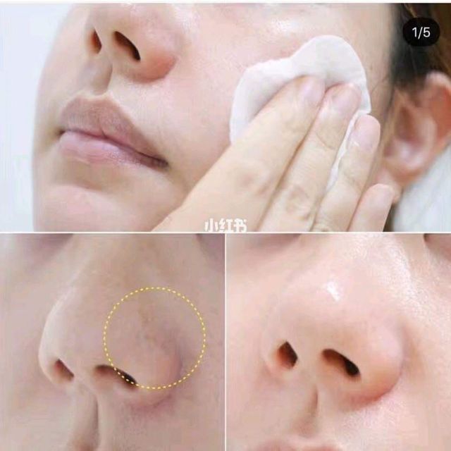 {Cosrx} Bông tẩy tế bào chết Cosrx One Step Original Clear Pad | BigBuy360 - bigbuy360.vn