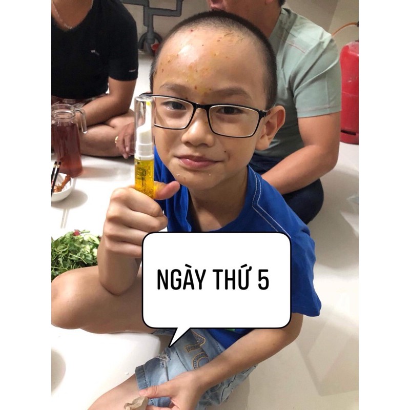Bút tri thâm sẹo Quin