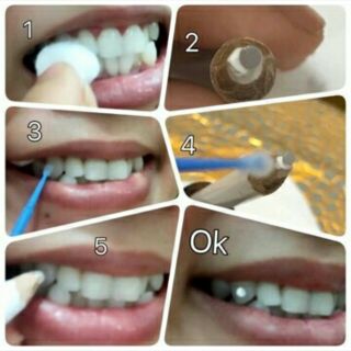 Bộ đá đính răng kèm keo và bút