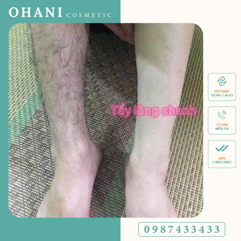 Kem tẩy lông chanh gấc Diamond Skin