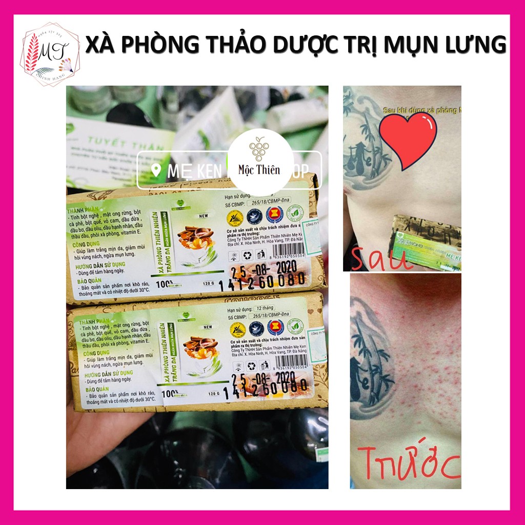 Xà Phòng Thảo Dược Sạch Mụn Lưng Mẹ Ken 120gr - Xà Bông Cải Thiện Thâm Mông, Hôi Nách Và Trắng Da