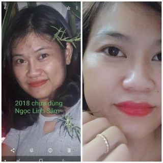 Serum thảo dược Linh Ngọc Sâm