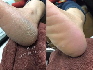 Cây chà gót chân inox làm nail